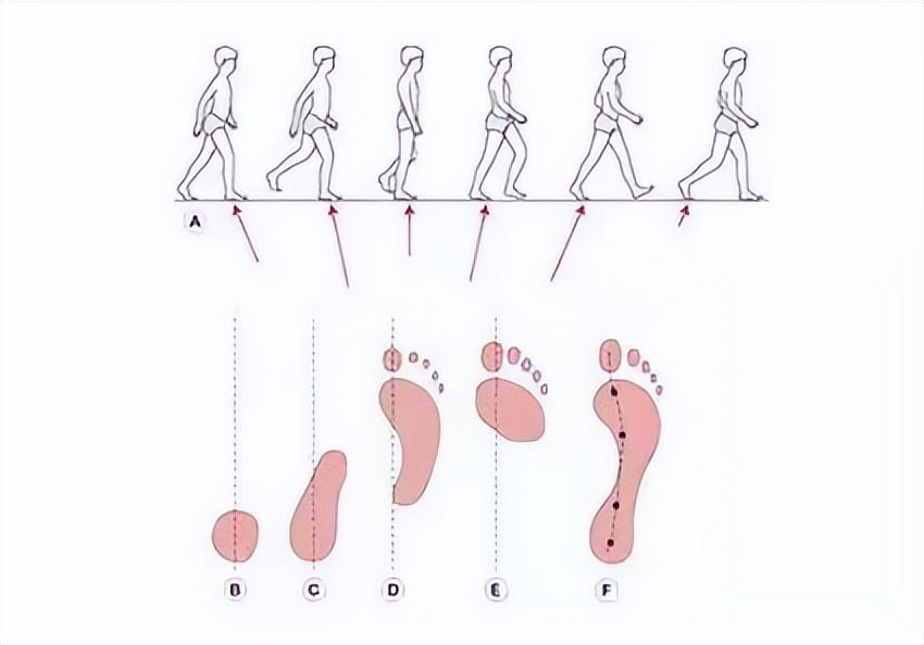 九个月宝宝脚尖着地，原因、影响及应对策略